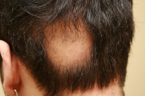 10 Common Causes of Hair Loss